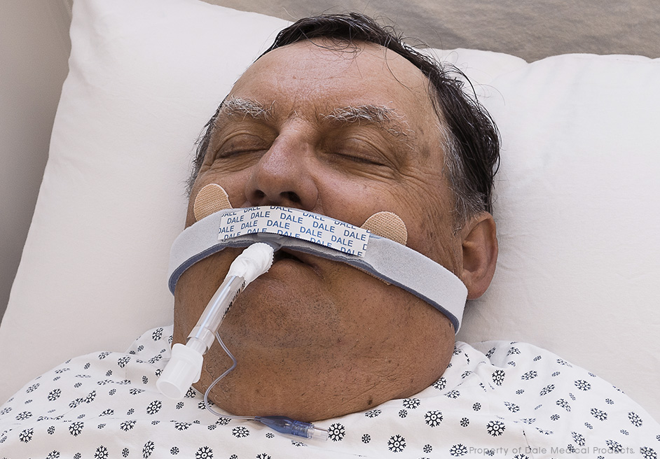 Soporte de Tubo Endotraqueal BreezeLock®
