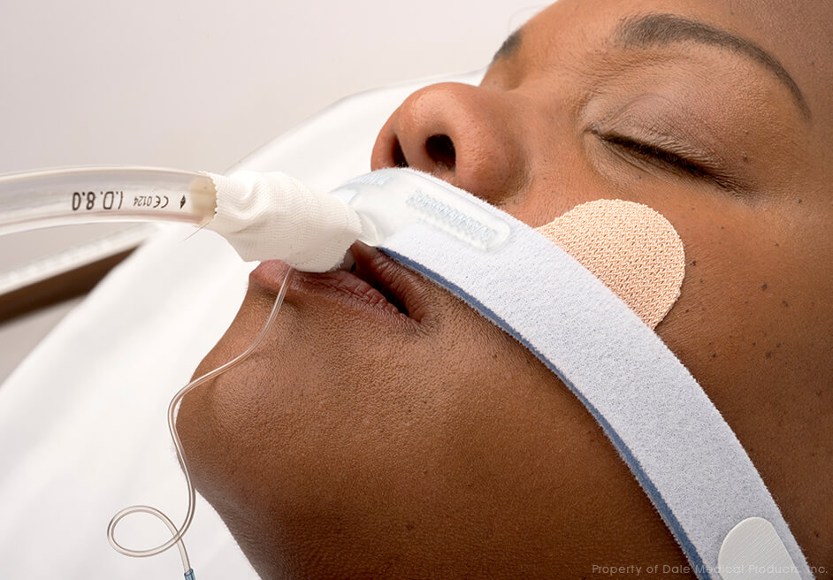 Soporte de Tubo Endotraqueal Stabilock