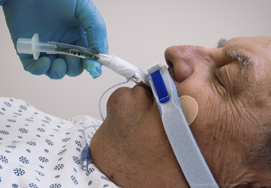 Soporte de Tubo Endotraqueal BreezeLock®